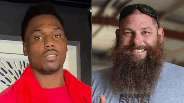 Syko Stu Improving but Dealing With Serious Facial Injuries, Friend Says